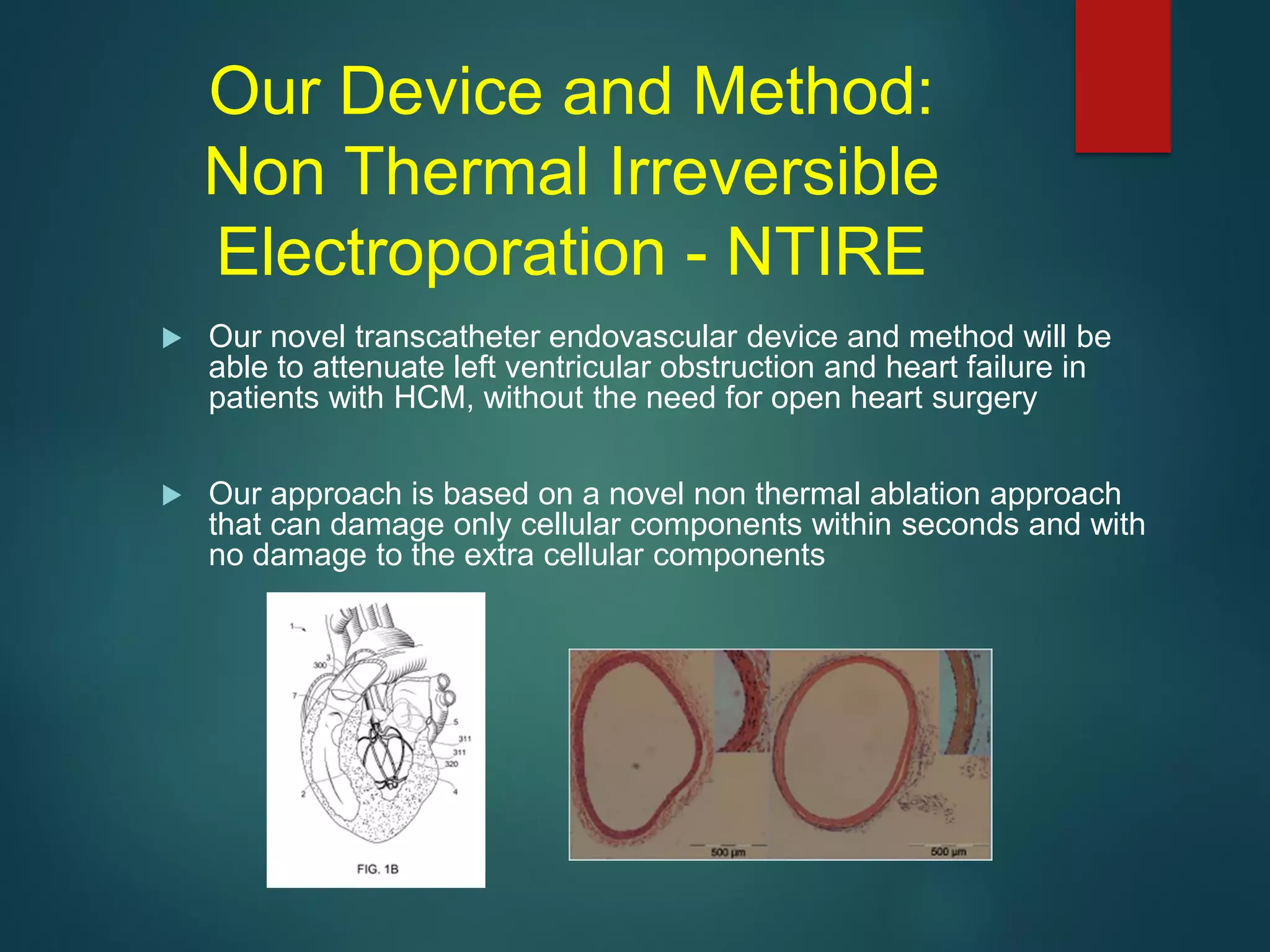 Our Device and Method:
Non Thermal Irreversible
Electroporation - NTIRE
 Our novel transcatheter endovascular device and method will be
able to attenuate left ventricular obstruction and heart failure in
patients with HCM, without the need for open heart surgery
 Our approach is based on a novel non thermal ablation approach
that can damage only cellular components within seconds and with
no damage to the extra cellular components
 