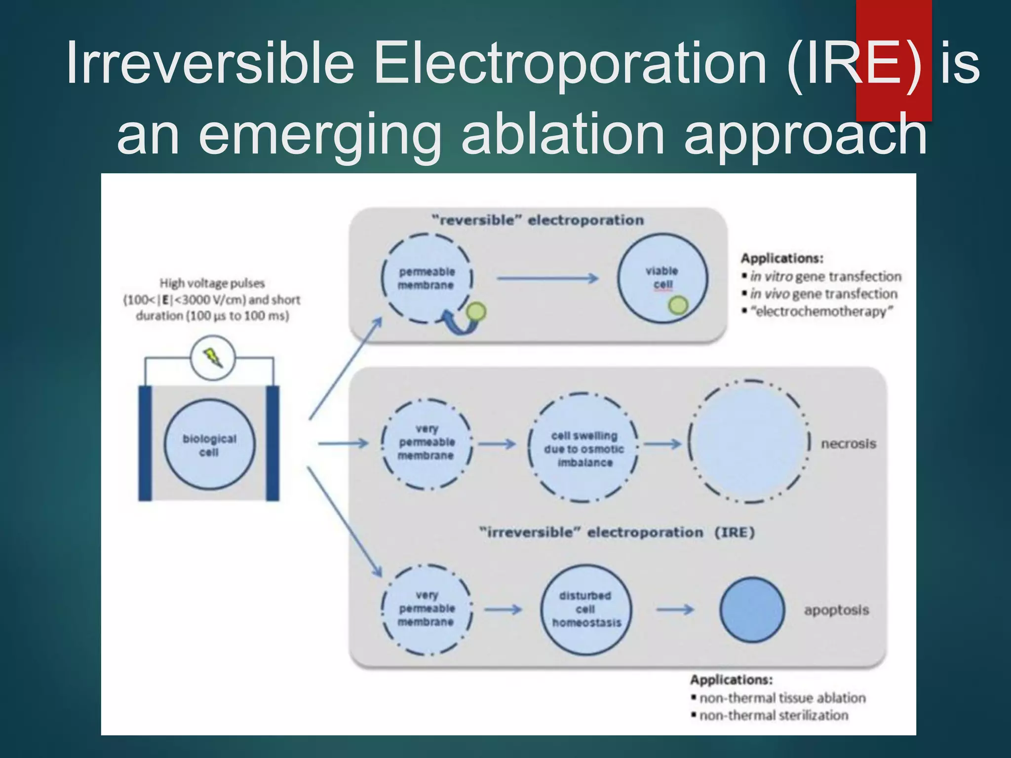 Irreversible Electroporation (IRE) is
an emerging ablation approach
 