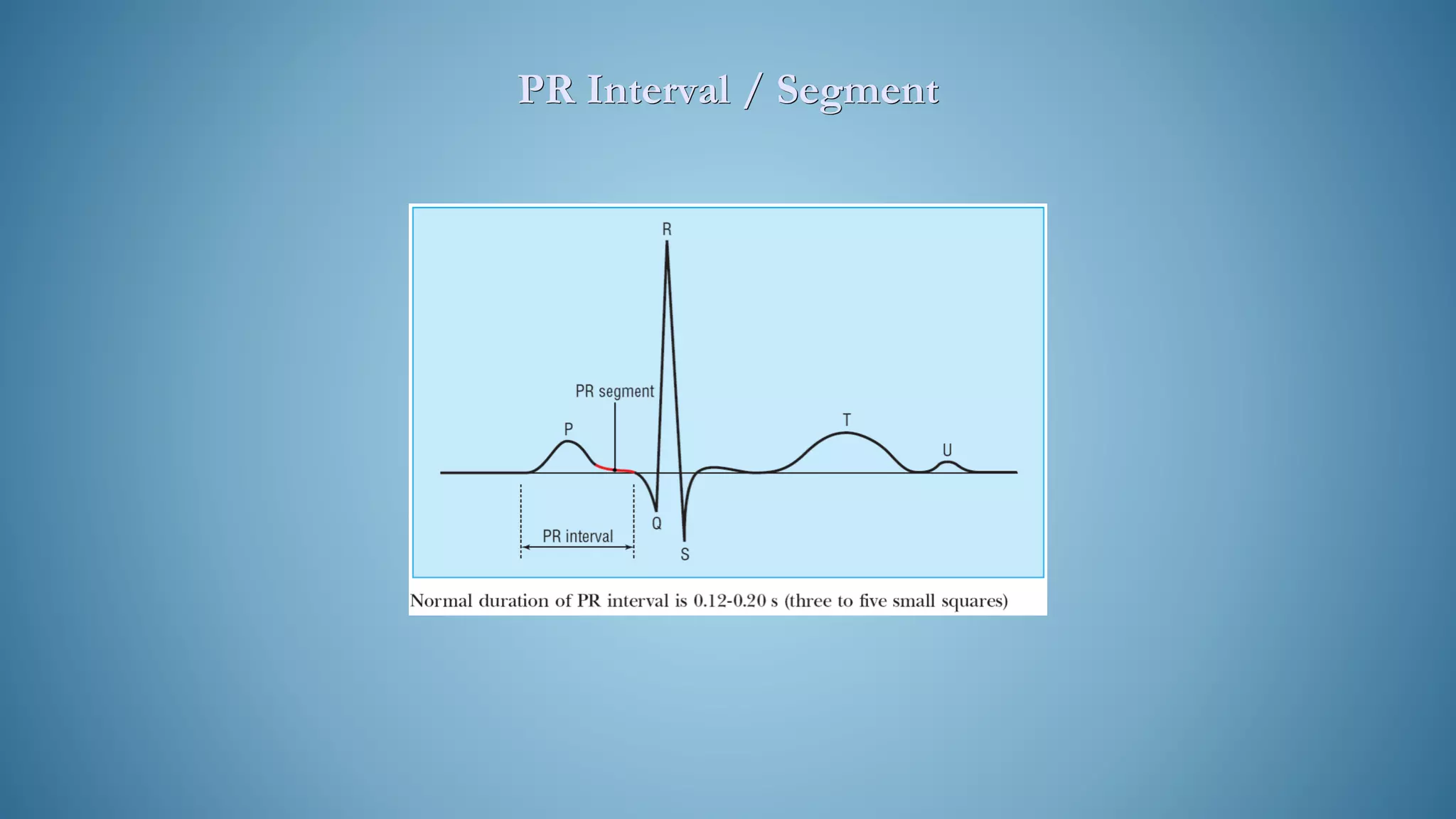 PR Interval / Segment
 