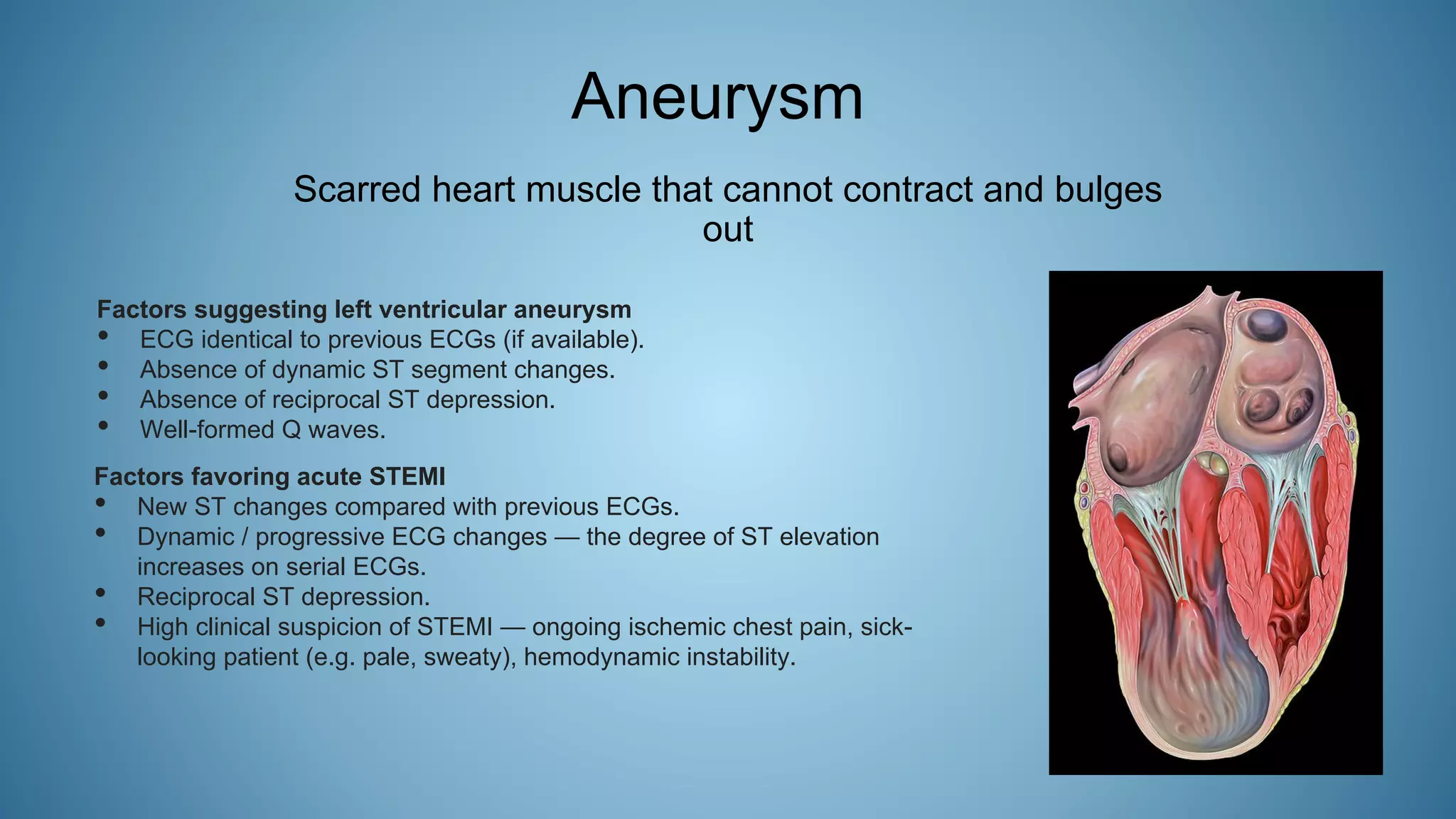 Aneurysm
Scarred heart muscle that cannot contract and bulges
out
Factors suggesting left ventricular aneurysm
• ECG identical to previous ECGs (if available).
• Absence of dynamic ST segment changes.
• Absence of reciprocal ST depression.
• Well-formed Q waves.
Factors favoring acute STEMI
• New ST changes compared with previous ECGs.
• Dynamic / progressive ECG changes — the degree of ST elevation
increases on serial ECGs.
• Reciprocal ST depression.
• High clinical suspicion of STEMI — ongoing ischemic chest pain, sick-
looking patient (e.g. pale, sweaty), hemodynamic instability.
 