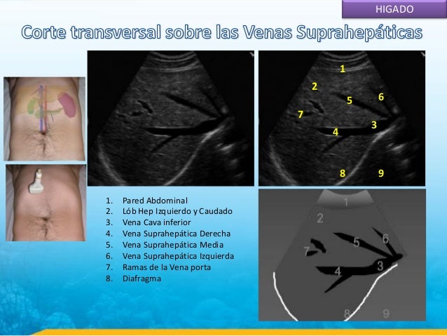 Que se puede ver en una ecografia abdominal