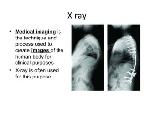 X ray  Medical imaging  is the technique and process used to create  images  of the human body for clinical purposes   X-ray is often used for this purpose. 