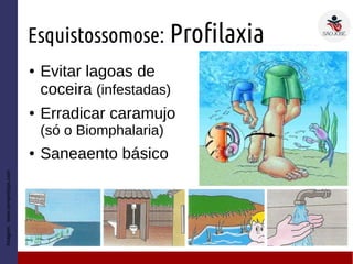 Esquistossomose: Profilaxia
● Evitar lagoas de
coceira (infestadas)
● Erradicar caramujo
(só o Biomphalaria)
● Saneaento básico
Imagem:www.sempretops.com
 