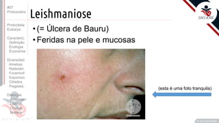 Prof. Kyoshi Beraldo
©
Leishmaniose
• (= Úlcera de Bauru)
• Feridas na pele e mucosas
(esta é uma foto tranquila)
#07
Protozoário
Protoctista
Eukarya
Caracteriz.
Definição
Ecologia
Economia
Diversidad.
Amebas
Radiolári.
Foraminif
Esporozo.
Ciliados
Flagelad,
Doenças
Amebías.
Leishm.
Chagas
Malária
 