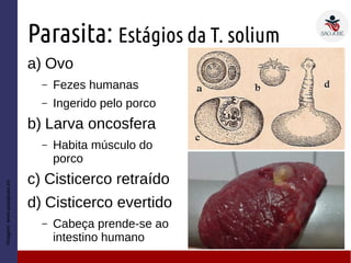 Parasita: Estágios da T. solium
a) Ovo
– Fezes humanas
– Ingerido pelo porco
b) Larva oncosfera
– Habita músculo do
porco
c) Cisticerco retraído
d) Cisticerco evertido
– Cabeça prende-se ao
intestino humano
Imagem:www.pasapues.es
 
