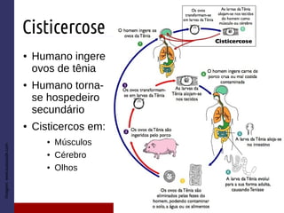 Cisticercose
● Humano ingere
ovos de tênia
● Humano torna-
se hospedeiro
secundário
● Cisticercos em:
● Músculos
● Cérebro
● Olhos
Imagem:www.tuasaude.com
 