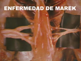 ENFERMEDAD DE MAREK
 