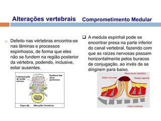 Alterações vertebrais
 Defeito nas vértebras encontra-se
nas lâminas e processos
espinhosos, de forma que eles
não se fundem na região posterior
da vértebra, podendo, inclusive,
estar ausentes.
Comprometimento Medular
 A medula espinhal pode se
encontrar presa na parte inferior
do canal vertebral, fazendo com
que as raízes nervosas passam
horizontalmente pelos buracos
de conjugação, ao invés de se
dirigirem para baixo.
 