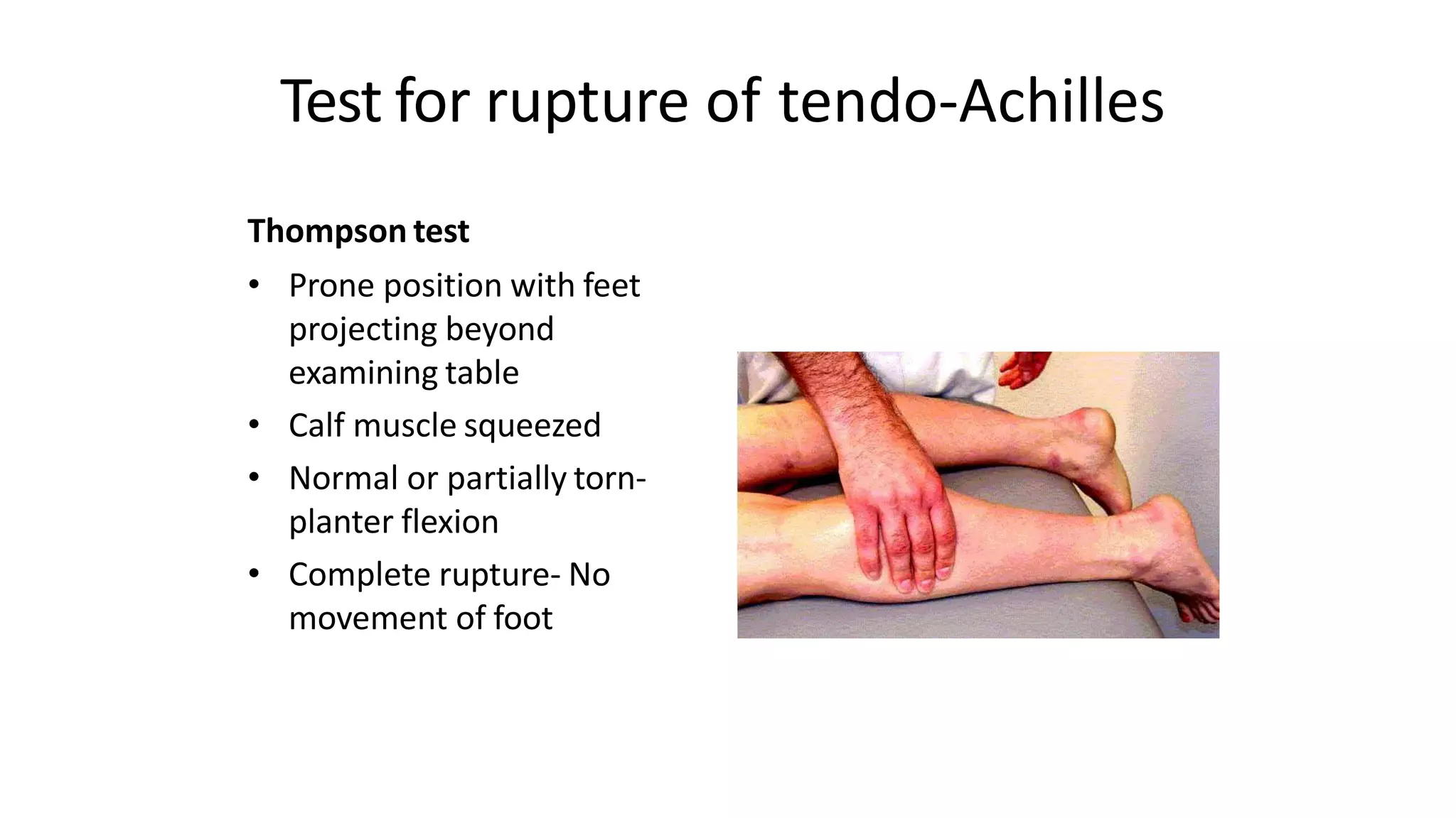 2 Evaluating for Syndesmotic injury.pptx