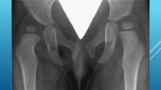 Radiografías diagnostico por imágenes