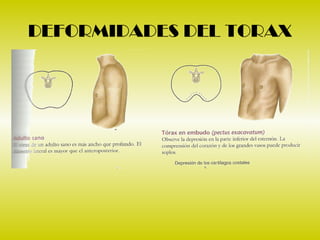Torax Ex 2 examen de torax | PPT