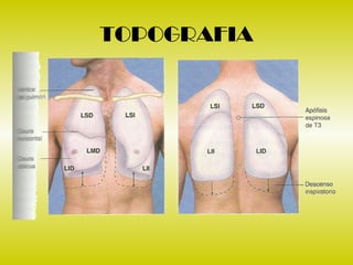 Torax Ex 2 examen de torax | PPT