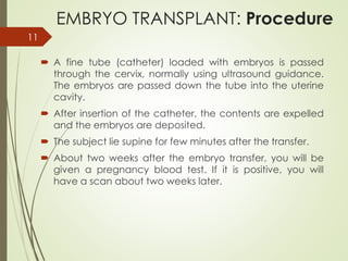 Egg Transplantation | PPTX