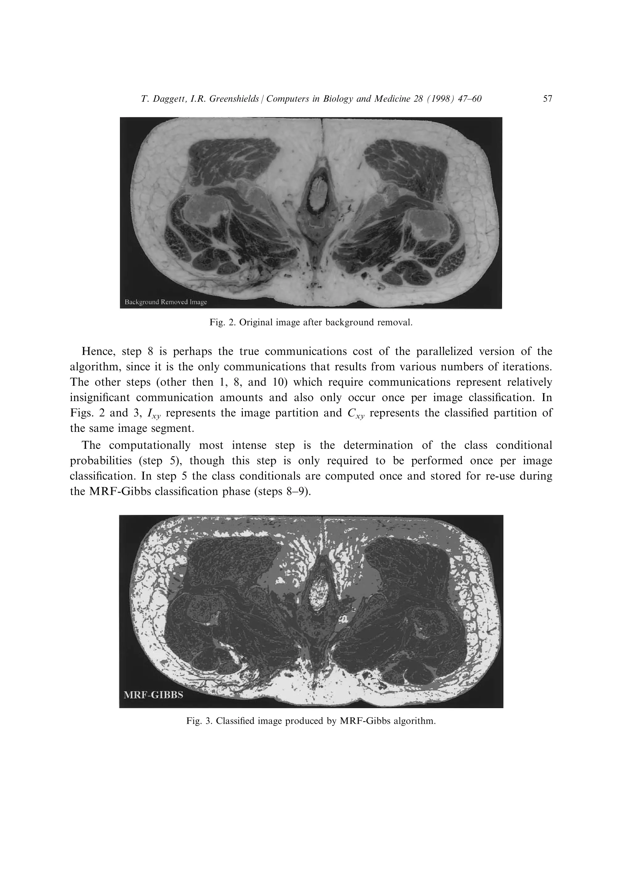 Hence, step 8 is perhaps the true communications cost of the parallelized version of the
algorithm, since it is the only communications that results from various numbers of iterations.
The other steps (other then 1, 8, and 10) which require communications represent relatively
insigni®cant communication amounts and also only occur once per image classi®cation. In
Figs. 2 and 3, Ixy represents the image partition and Cxy represents the classi®ed partition of
the same image segment.
The computationally most intense step is the determination of the class conditional
probabilities (step 5), though this step is only required to be performed once per image
classi®cation. In step 5 the class conditionals are computed once and stored for re-use during
the MRF-Gibbs classi®cation phase (steps 8±9).
Fig. 2. Original image after background removal.
Fig. 3. Classi®ed image produced by MRF-Gibbs algorithm.
T. Daggett, I.R. Greenshields / Computers in Biology and Medicine 28 (1998) 47±60 57
 