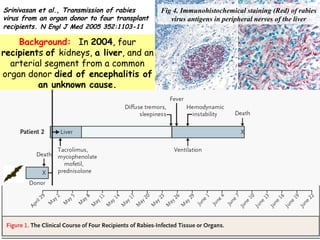 Fig 4. Immunohistochemical staining (Red) of rabies 
virus antigens in peripheral nerves of the liver 
Srinivasan et al., Transmission of rabies 
virus from an organ donor to four transplant 
recipients. N Engl J Med 2005 352:1103-11 
Background: In 2004, four 
recipients of kidneys, a liver, and an 
arterial segment from a common 
organ donor died of encephalitis of 
an unknown cause. 
 