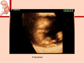 9 semanas
 