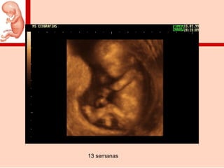 13 semanas
 