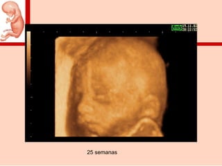 25 semanas
 