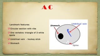 A C
Landmark features:
 Circular section with ribs
 One vertebra -triangle of 3 white
spots
 Umbilical vein - hockey stick
 Stomach
 