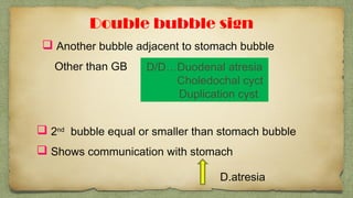  2nd
bubble equal or smaller than stomach bubble
 Shows communication with stomach
D/D…Duodenal atresia
Choledochal cyct
Duplication cyst
Double bubble sign
 Another bubble adjacent to stomach bubble
Other than GB
D.atresia
 