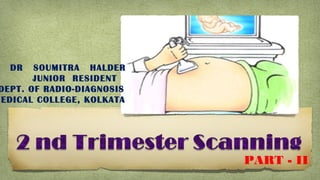 DR SOUMITRA HALDER
JUNIOR RESIDENT
DEPT. OF RADIO-DIAGNOSIS
MEDICAL COLLEGE, KOLKATA
PART - II
 