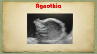 Agnothia
 