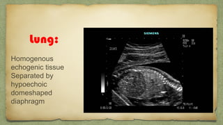 Lung:
Homogenous
echogenic tissue
Separated by
hypoechoic
domeshaped
diaphragm
 