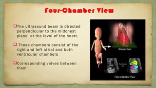 The ultrasound beam is directed
perpendicular to the midchest
plane at the level of the heart.
 These chambers consist of the
right and left atrial and both
ventricular chambers
Corresponding valves between
them
Four-Chamber View
 