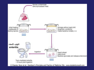 ‫األمعاء‬ ‫التهاب‬
enteritis
 