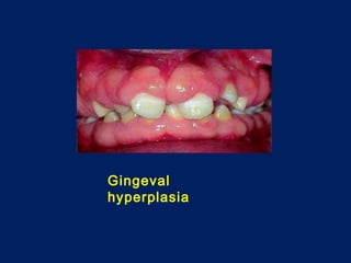 2 gastrointestinal disease in kidney disease 1 | PPT