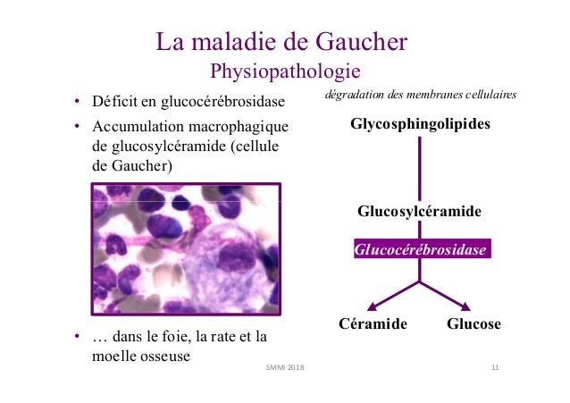 Maladie de gaucher Jérôme Stirnemann SMMI _21_9_2018_