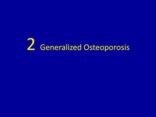 2 Generalized Osteoporosis
 