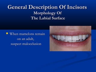 General Description Of IncisorsGeneral Description Of Incisors
Morphology OfMorphology Of
The Labial SurfaceThe Labial Surface
 When mamelons remainWhen mamelons remain
on an adult,on an adult,
suspect malocclusionsuspect malocclusion
 