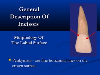  Perikymata - are fine horizontal lines on thePerikymata - are fine horizontal lines on the
crown surfacecrown surface
GeneralGeneral
Description OfDescription Of
IncisorsIncisors
Morphology OfMorphology Of
The Labial SurfaceThe Labial Surface
 
