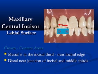 MaxillaryMaxillary
Central IncisorCentral Incisor
Labial SurfaceLabial Surface
Crown - Contact AreasCrown - Contact Areas
 Mesial is in the incisal third - near incisal edgeMesial is in the incisal third - near incisal edge
 Distal near junction of incisal and middle thirdsDistal near junction of incisal and middle thirds
D M
 