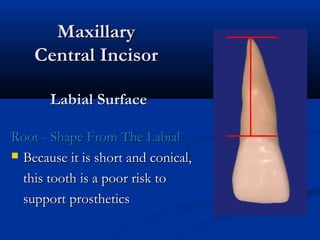 MaxillaryMaxillary
Central IncisorCentral Incisor
Labial SurfaceLabial Surface
Root - Shape From The LabialRoot - Shape From The Labial
 Because it is short and conical,Because it is short and conical,
this tooth is a poor risk tothis tooth is a poor risk to
support prostheticssupport prosthetics
 