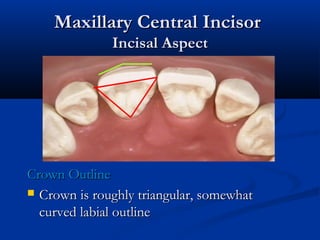 Maxillary Central IncisorMaxillary Central Incisor
Incisal AspectIncisal Aspect
Crown OutlineCrown Outline
 Crown is roughly triangular, somewhatCrown is roughly triangular, somewhat
curved labial outlinecurved labial outline
 
