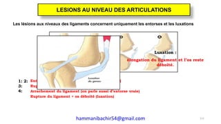 Les lésions aux niveaux des ligaments concernent uniquement les entorses et les luxations
1: 2:
3:
4:
Entorse simple (le ligament est étiré et aminci)
Rupture du ligament (on parle d’entorse vraie)
Arrachement du ligament (on parle aussi d’entorse vraie)
Rupture du ligament + os déboîté (luxation)
Luxation :
élongation du ligament et l’os reste
déboîté.
111
LESIONS AU NIVEAU DES ARTICULATIONS
hammanibachir54@gmail.com
 