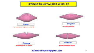 Crampe Elongation
Claquage Déchirure
Le muscle est toujours contracté Le muscle est étiré
Rupture partiel du muscle Muscle totalement déchiré
115
LESIONS AU NIVEAU DES MUSCLES
hammanibachir54@gmail.com
 