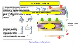 La répétition de mouvement imposant au
disque intervertébral des efforts anormaux
(mouvement de flexion de grande amplitude,
mouvements de rotation) conduira à court,
moyen ou long terme à une détérioration du
disque. En particulier les lamelles de l’anneau
fibreux risquent de se distendre ou de se
craqueler.
Ligament + nerfs
sensitifs
Au moment du redressement, une partie du
noyau peut se trouver coincée dans ces
lamelles détériorées. Les nerfs sensitifs irrités,
situés à la périphérie du disque intervertébral,
provoquent alors une douleur violente
entraînant par reflexe un blocage musculaire
en position semi-fléchie.
Au moment du redressement, une partie du
noyau peut se trouver coincée dans ces
lamelles détériorées. Les nerfs sensitifs
irrités, situés à la périphérie du disque
intervertébral, provoquent alors une douleur
violente entraînant par reflexe un blocage
musculaire en position semi-fléchie.
MESURE DE PREVENTION
127
L’ACCIDENT DISCAL
hammanibachir54@gmail.com
 