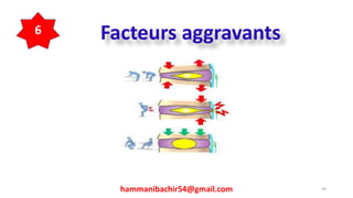 hammanibachir54@gmail.com 39
Facteurs aggravants6
 