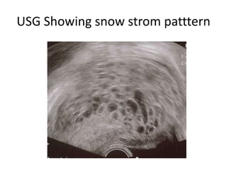 USG Showing snow strom patttern
 