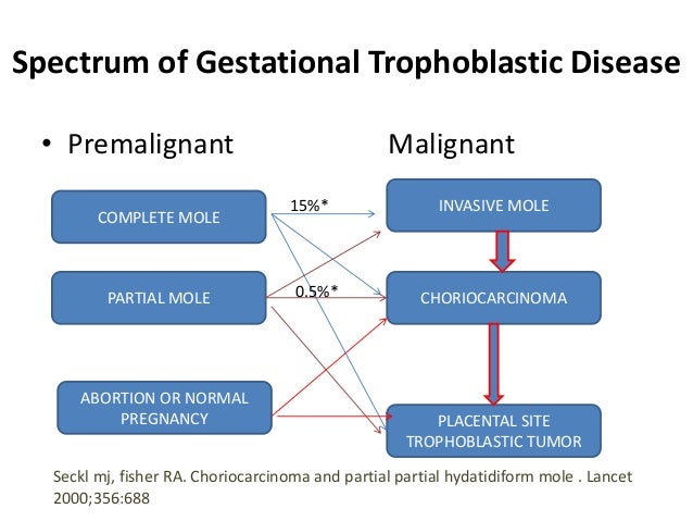 Molar pregnancy