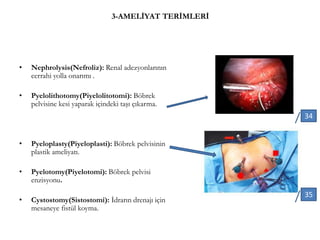 3-AMELİYAT TERİMLERİ
• Nephrolysis(Nefroliz): Renal adezyonlarının
cerrahi yolla onarımı .
• Pyelolithotomy(Piyelolitotomi): Böbrek
pelvisine kesi yaparak içindeki taşı çıkarma.
• Pyeloplasty(Piyeloplasti): Böbrek pelvisinin
plastik ameliyatı.
• Pyelotomy(Piyelotomi): Böbrek pelvisi
enzisyonu.
• Cystostomy(Sistostomi): İdrarın drenajı için
mesaneye fistül koyma.
34
35
 