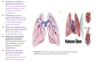 Pulmonary embolism
(pulmoner emboli): Bir
pıhtı veya yabancı maddenin
pulmoner arterin bir dalını
tıkaması ve dolaşımın
engellenmesi.
 Pulmonary oedema
(pulmoner ödem): Akciğer
ödemi. Akciğer dokularında
ve alveollerde anormal,
yaygın sıvı birikimi.
 Pulmonary hypertension
(pulmoner hipertansiyon):
Pulmoner arterde kan
basıncının yüksek oluşu.
 Pulmonary thrombosis
(pulmoner tromboz):
Herhangi bir pulmoner kan
damarında pıhtı meydana
gelmesi ve dolaşımın
engellenmesi.
 Pulmonary infarction
(pulmoner enfarktüs):
Çok defa embolizm
sebebiyle akciğerin bir kısım
dokusuna kan gitmemesi.
Embolizm: Embolizm, bir arterin emboli (kan dolaşımında taşınan bir
madde parçası) ile tıkanmasını tanımlayan bir durumdur.
(25) (26)
 
