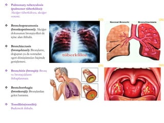  Pulmonary tuberculosis
(pulmoner tüberküloz):
Akciğer tüberkülozu, akciğer
veremi.
 Bronchopneumonia
(bronkopnömoni): Akciğer
dokusunun bronşiyolleri de
içine alan iltihabı.
 Bronchiectasis
(bronşektazi): Bronşların,
doğuştan ya da sonradan
«geri dönüşümsüz» biçimde
genişlemesi.
 Bronchitis (bronşit): Bronş
ve bronşçukların
iltihaplanması.
 Bronchorrhagia
(bronkoraji): Bronşlardan
gelen kanama.
 Tonsillitis(tonsilit):
Bademcik iltihabı.
(27) (28)
(29) (30)
 