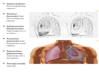  Empyema (ampiyem):
Plevra boşluğunda iltihap
toplanması.
 Hemothorax
(hemotoraks): Göğüs
(plevra) boşluğuna kan
toplanması.
 Hydropneumothorax
(hidropnömotoraks):
Göğüs boşluğuna hava ve
sıvı dolması.
 Pneumothorax
(pnömotoraks): Göğüs
boşluğunda hava veya gaz
toplanması.
 Pyopneumothorax
(piyopnömotoraks):
Göğüs boşluğuna irin ve
hava toplanması.
 Thoracalgia (torakalji):
Göğüs ağrısı
(31)
(32)
 