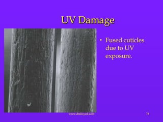 UV Damage Fused cuticles due to UV exposure. 