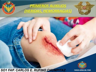 SO1 FAP. CARLOS E. RUFINO CHUMPITAZ.
PRIMEROS AUXILIOS
(HERIDAS, HEMORRAGIAS)
 