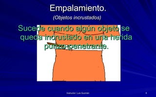 Empalamiento. (Objetos incrustados)   Sucede cuando algún objeto se queda incrustado en una herida punzo-penetrante . 